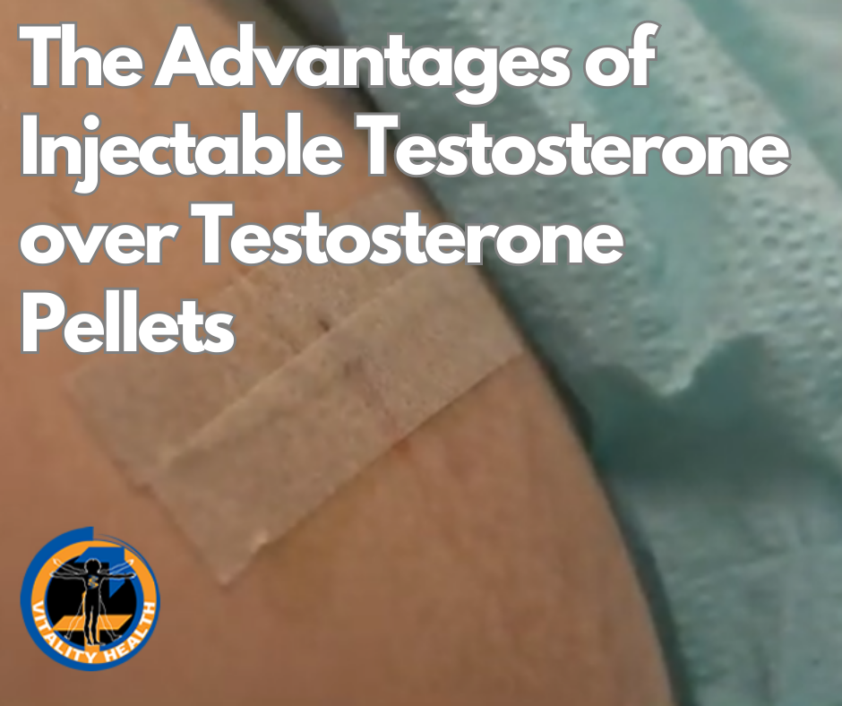 At Vitality Health SFL, we speak to and encounter many patients who currently are or have been treated for low testosterone in the past and have used testosterone pellets. We have found that the general consensus amongst many of these patients is that the pellet forms of therapy simply are not preferred by most. Let’s take a look at the advantages of injectable testosterone over testosterone pellets and why injectable testosterone may be considered better: