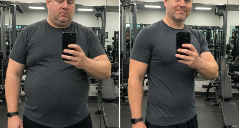 GLP1 before and after Vitality Health of South Florida