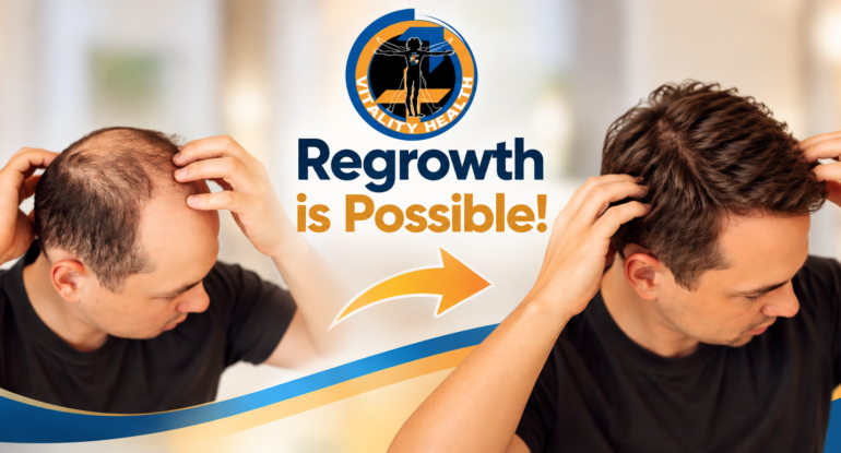 vitality health sfl hair restoration medical treatments