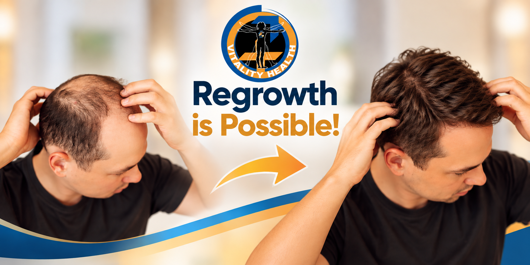 vitality health sfl hair restoration medical treatments